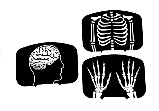 Învățare distractivă cu radiografii